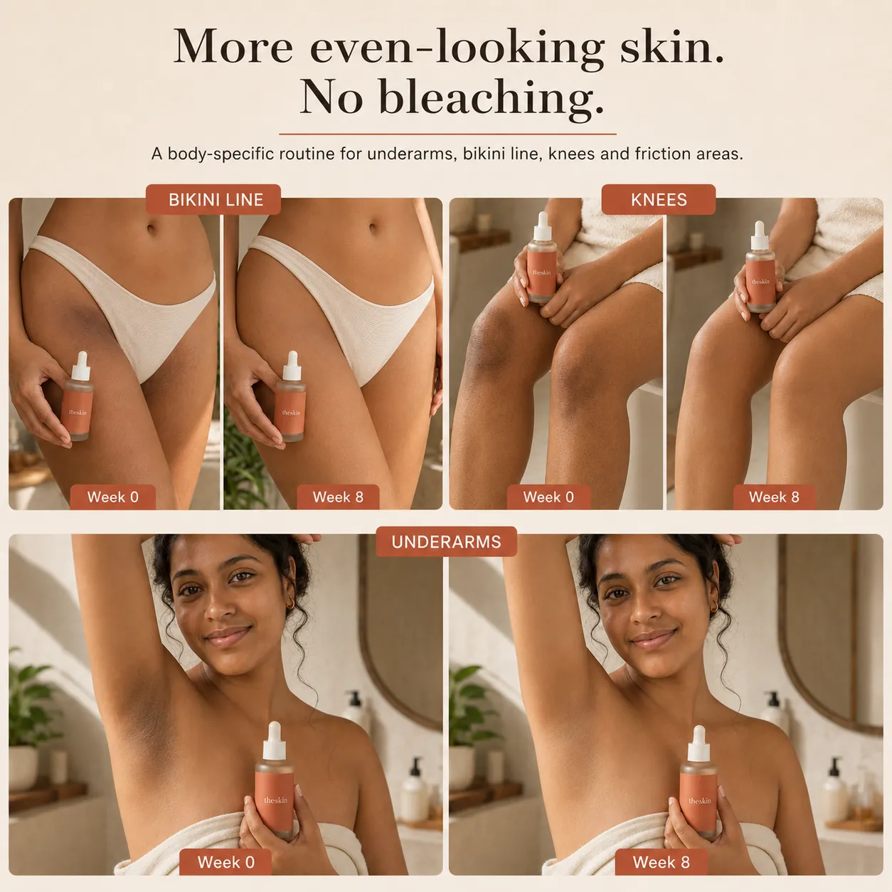 Before and after: appearance of more even tone after 8 weeks